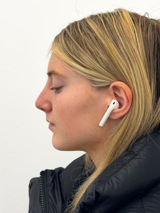 Rhinoplasty Before & After Gallery - Patient 396377 - Image 6