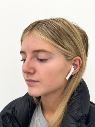 Rhinoplasty Before & After Gallery - Patient 396377 - Image 4