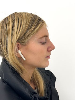 Rhinoplasty Before & After Gallery - Patient 396377 - Image 10