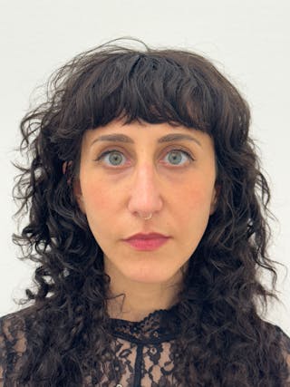 Rhinoplasty Before & After Gallery - Patient 181587 - Image 2