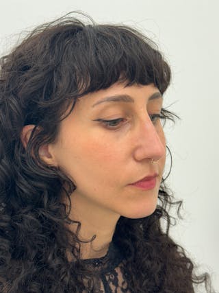 Rhinoplasty Before & After Gallery - Patient 181587 - Image 8
