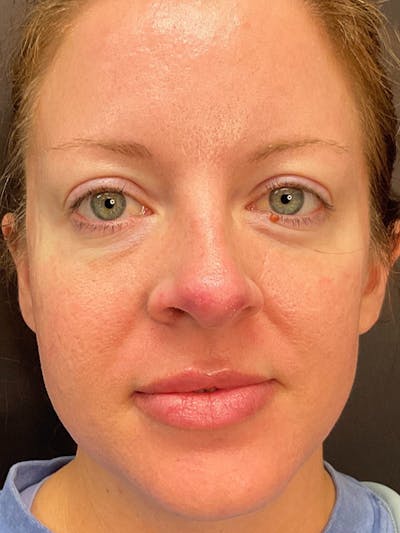 Skincare Before & After Gallery - Patient 131839899 - Image 1