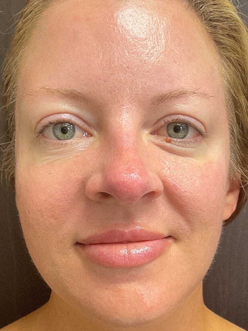 Skincare Before & After Gallery - Patient 131839899 - Image 2