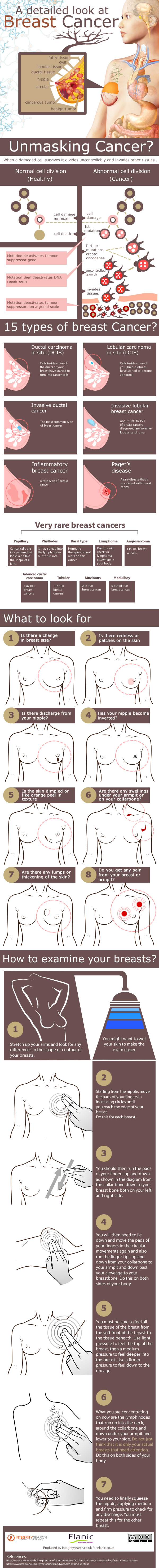Breast Cancer Infographic