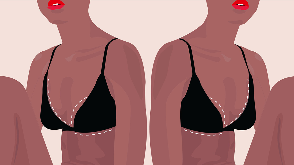 Breast Reduction Candidate Breast Reduction Candidate