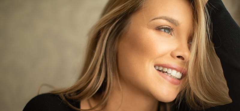 Close up of a woman's face showing dermal fillers in Glasgow.