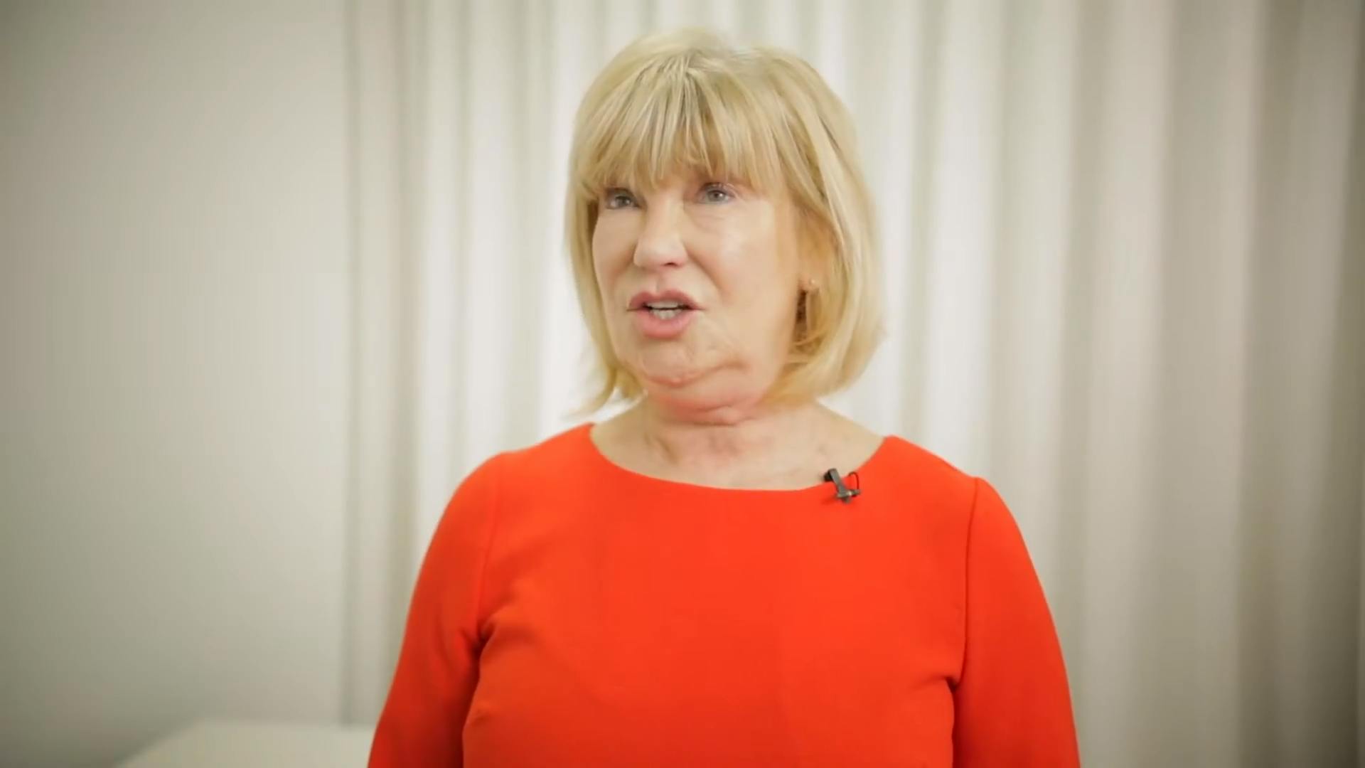 Hillary talks about her experience with Elanic's dermal fillers in Glasgow
