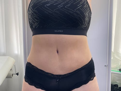 Before and After Image