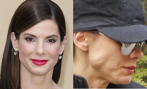 Sandra Bullock Blog Dr. Kimberly Lee