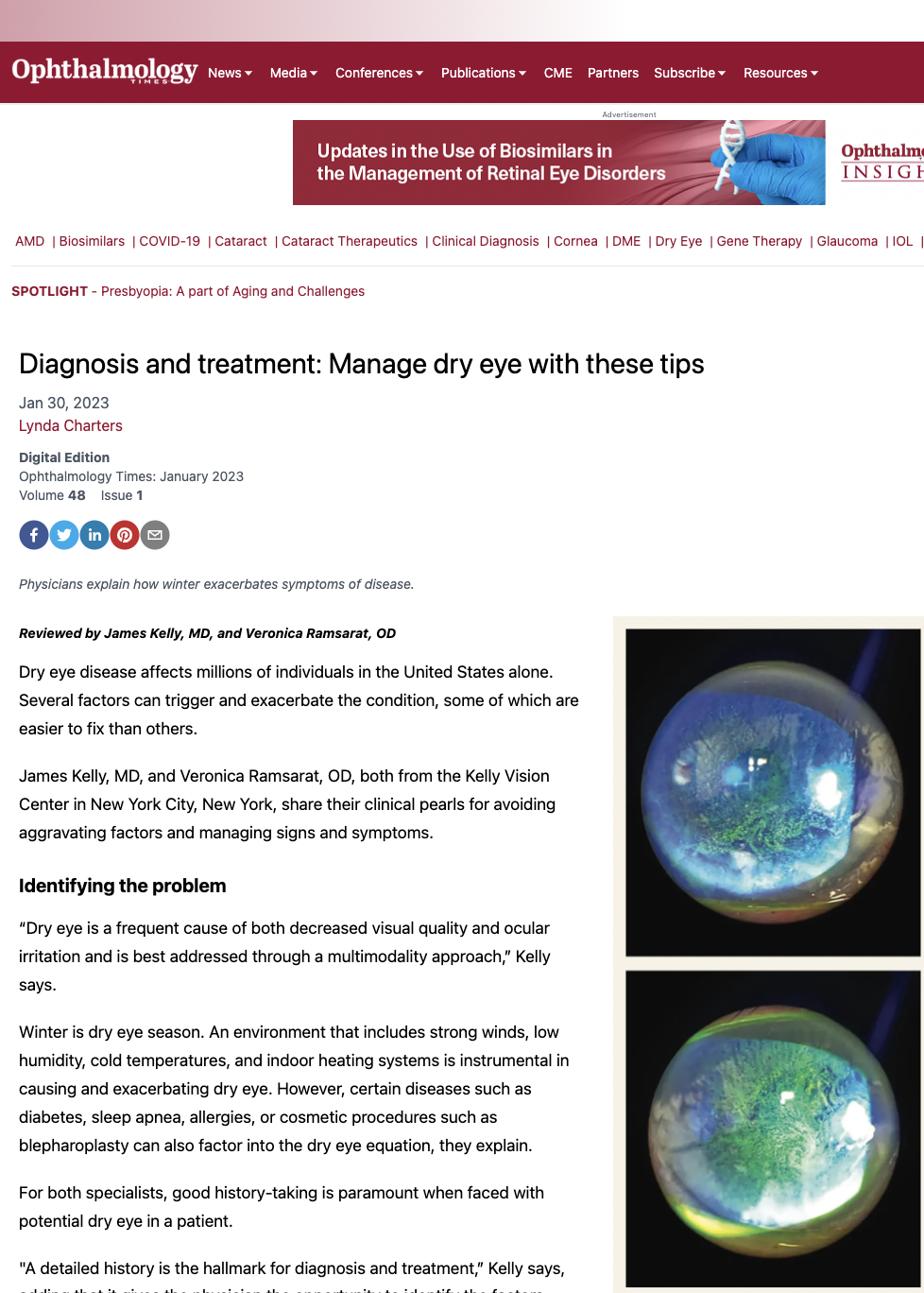 Screenshot of Dr. James Kelly's article in ophthalmologytimes.com