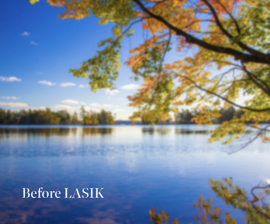 Farsightedness before LASIK with picture of lake and tree