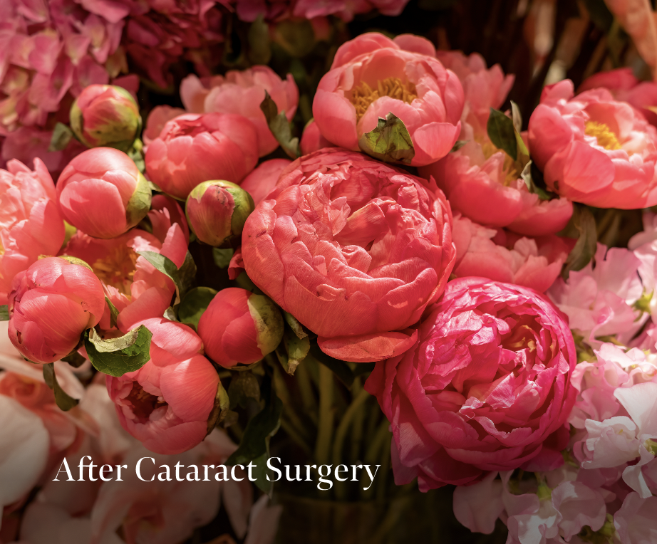 Color Distortion after cataract surgery with picture of flowers