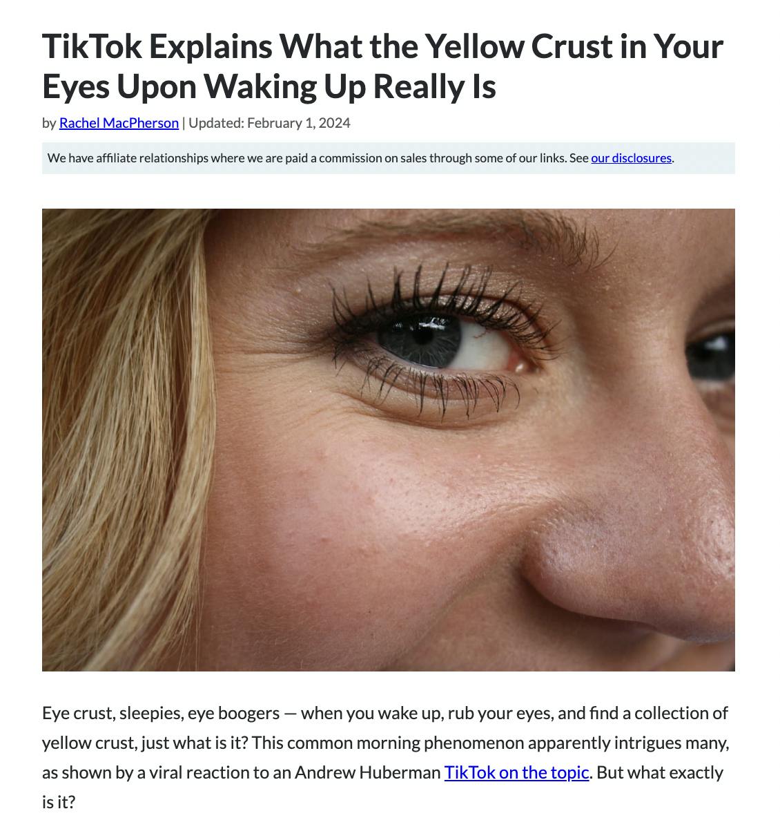 What Is Morning Eye Crust?