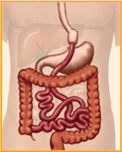 Gastric bypass