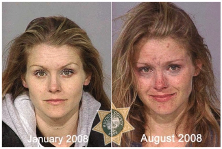 Faces of Meth: How Meth Addiction Affects People
