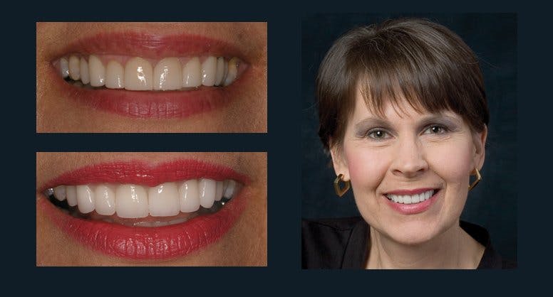 Smile Before & After Gallery - Patient 94064457 - Image 1
