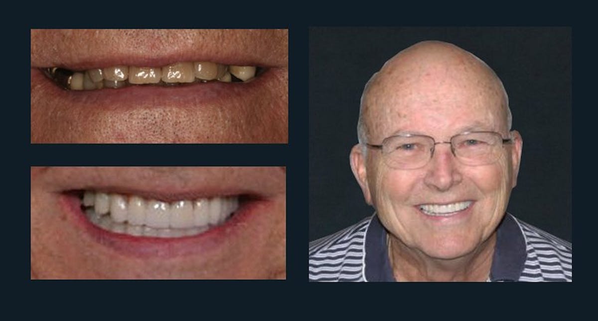 Smile Before & After Gallery - Patient 94064455 - Image 1