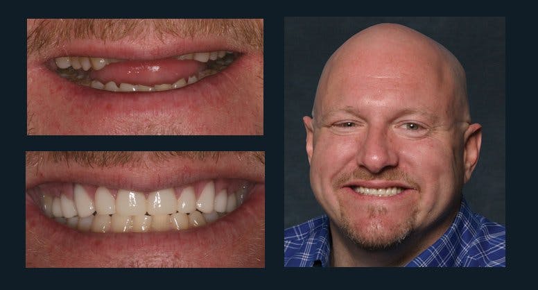 Smile Before & After Gallery - Patient 94064453 - Image 1