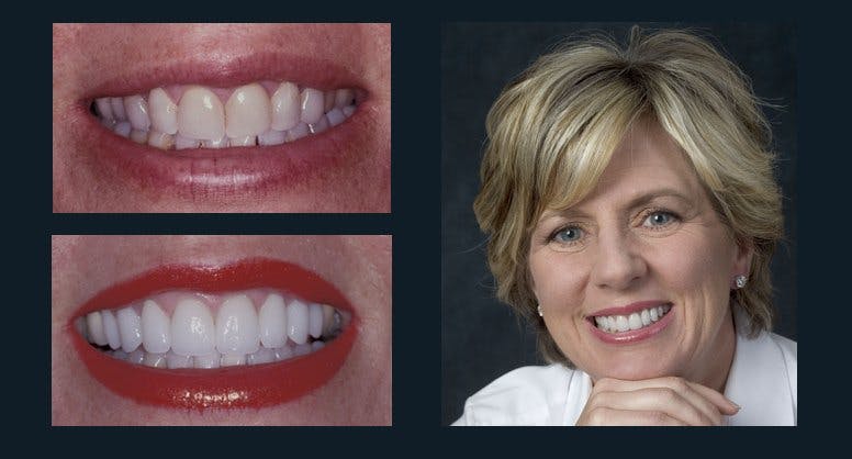 Smile Before & After Gallery - Patient 94064449 - Image 1