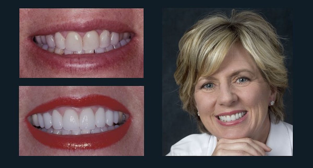 Smile Before & After Gallery - Patient 94064449 - Image 1