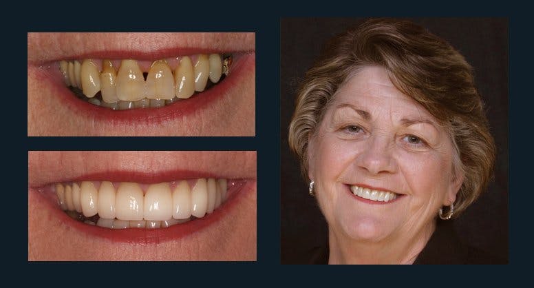 Smile Before & After Gallery - Patient 94064446 - Image 1