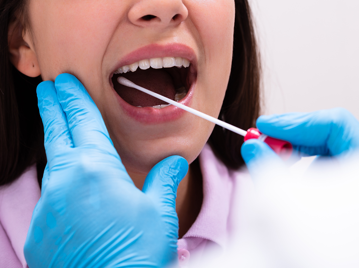 Oral DNA Test Admira Dentistry