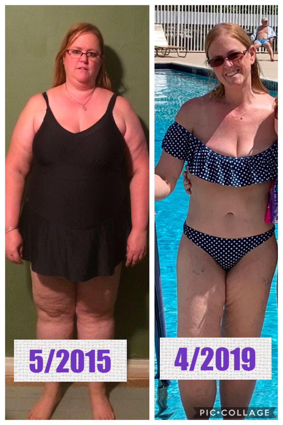 Patient before and after 01