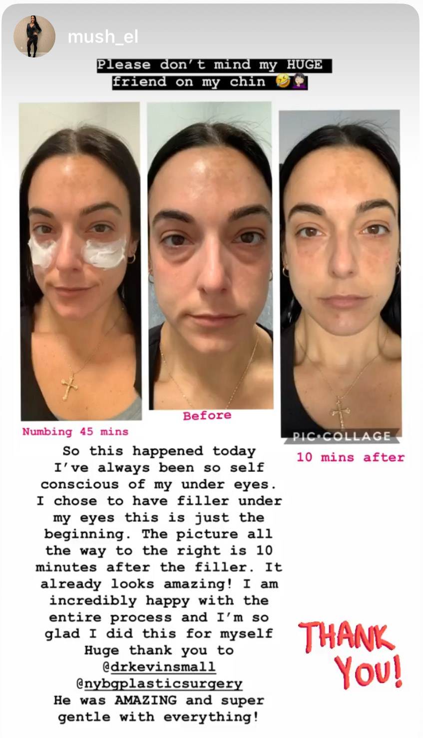 Patient before and after post
