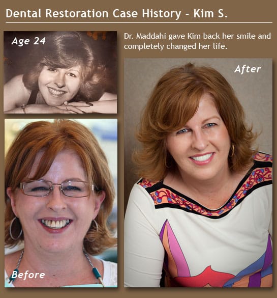 Dental history for Kim S.