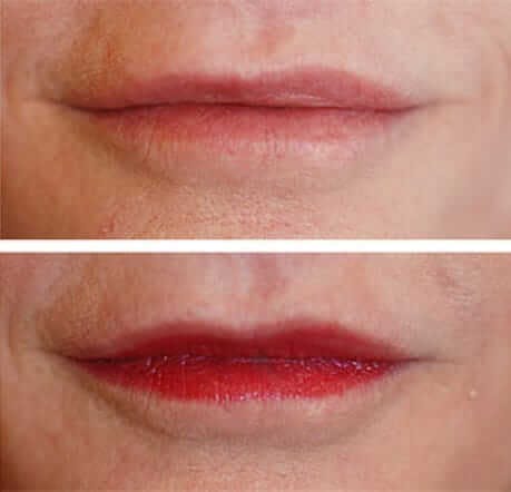 Anti aging dentistry before and after: close up of woman's smile before and after