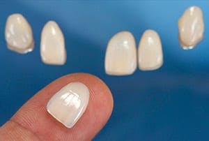 A Lumineer on a person's finger with more Lumineers in the background