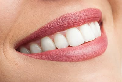 Close up of woman smiling with white teeth