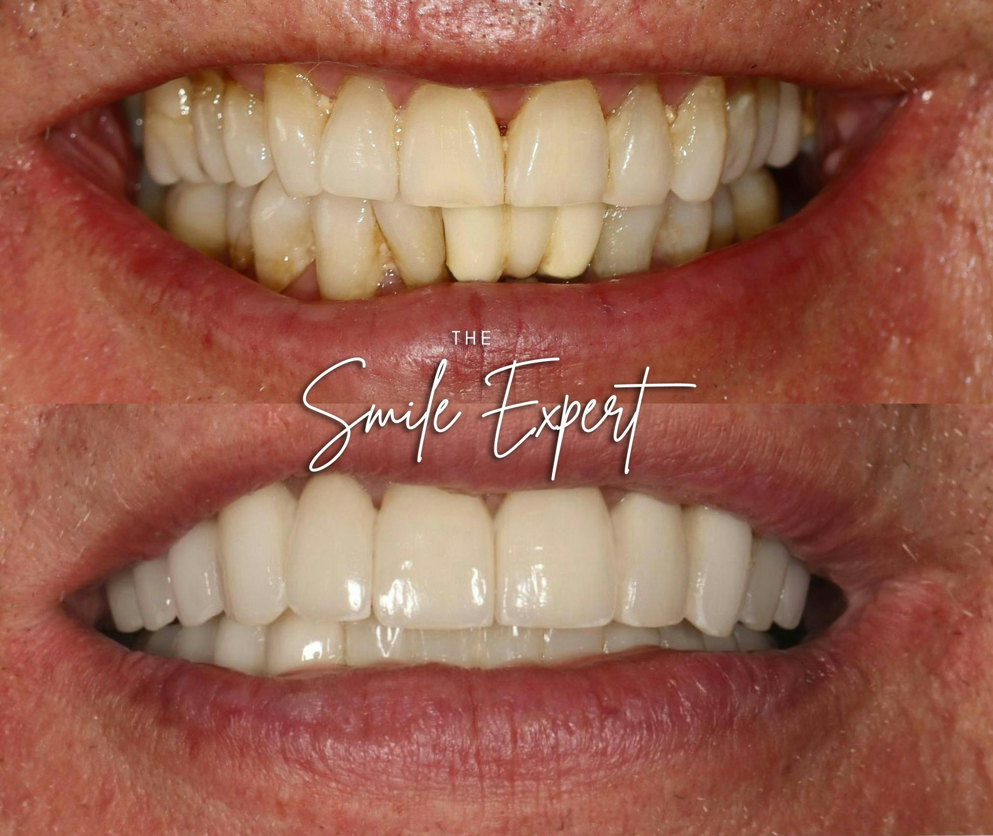 Smile Makeover Before & After Gallery - Patient 283051 - Image 1
