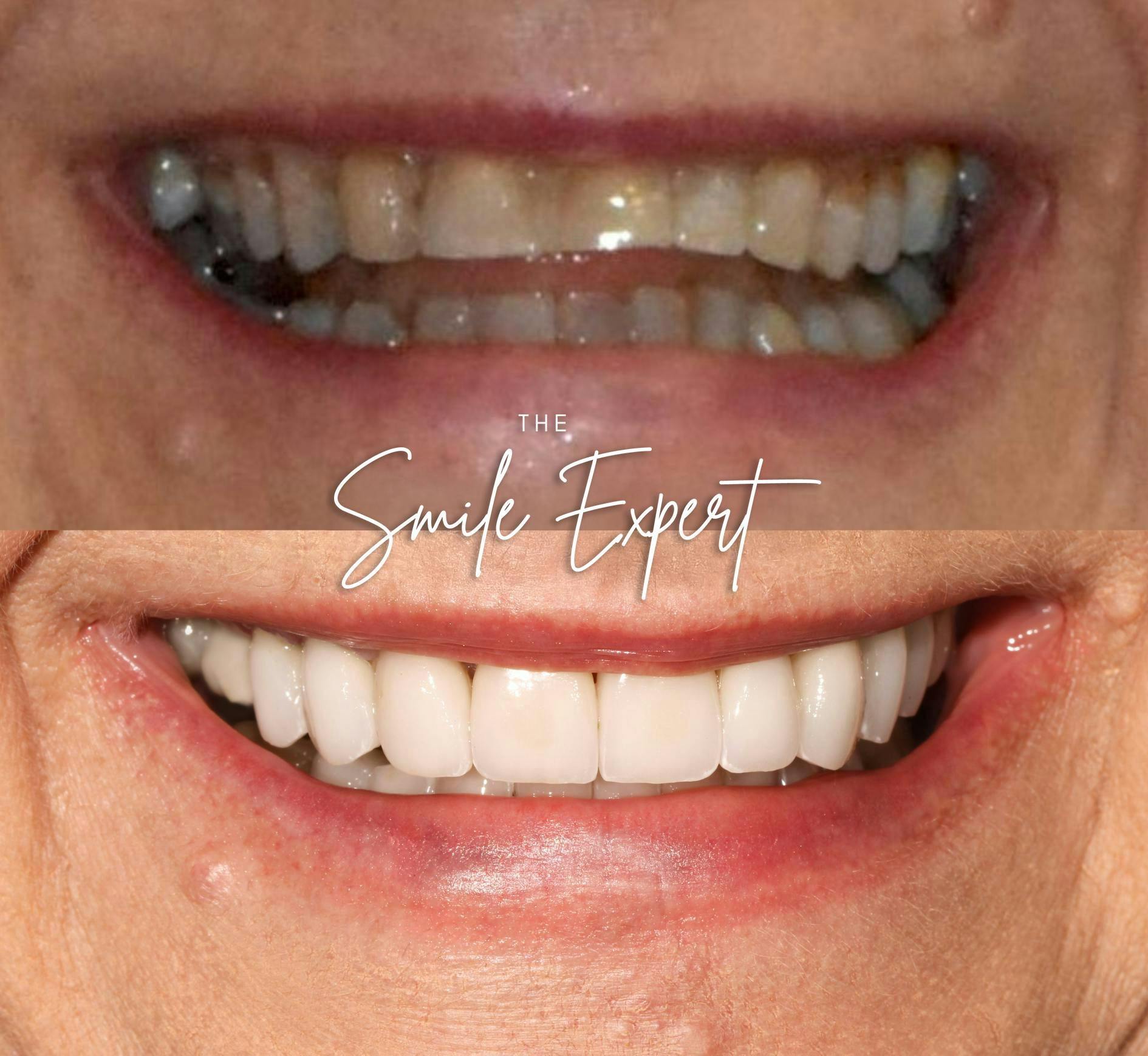 Smile Makeover Before & After Gallery - Patient 511048 - Image 1