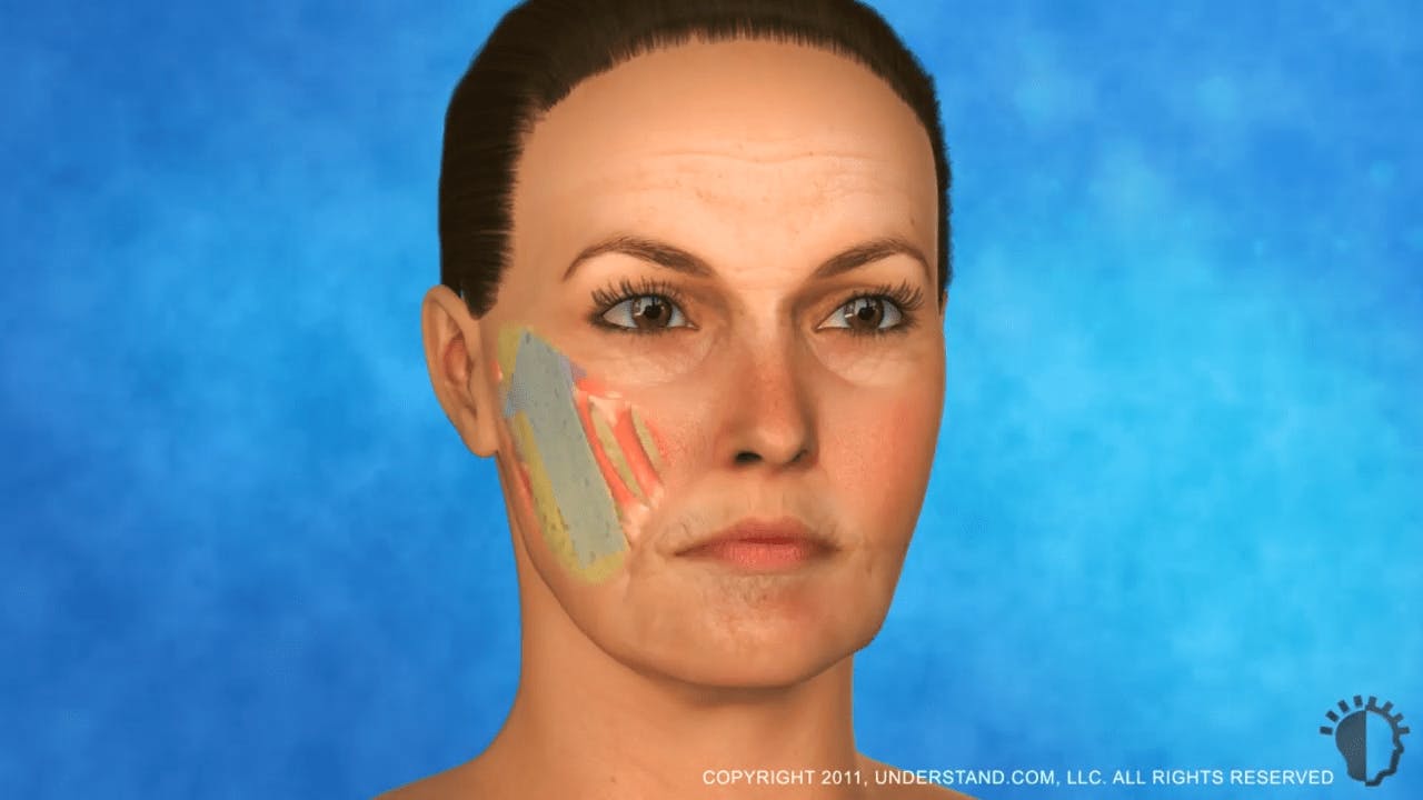 Rendering of a woman's face with cheeks muscles shown