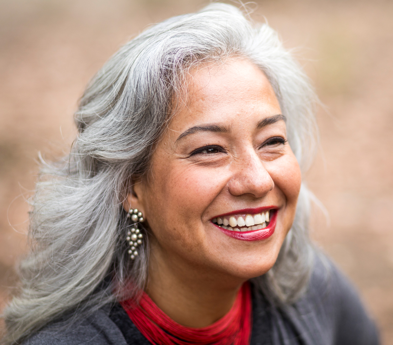 Facelift in Boise Boise Midface Lift Nava Face & Eye