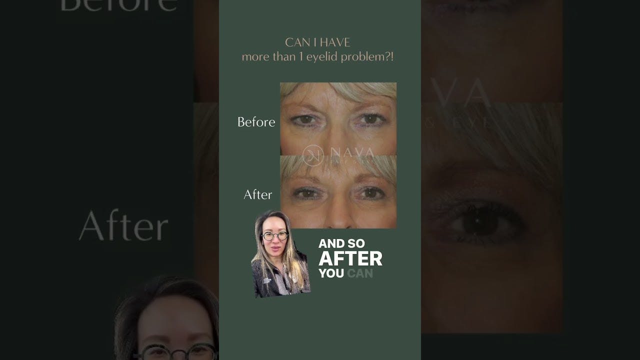 Dr. Vargason more than one eyelid problem video