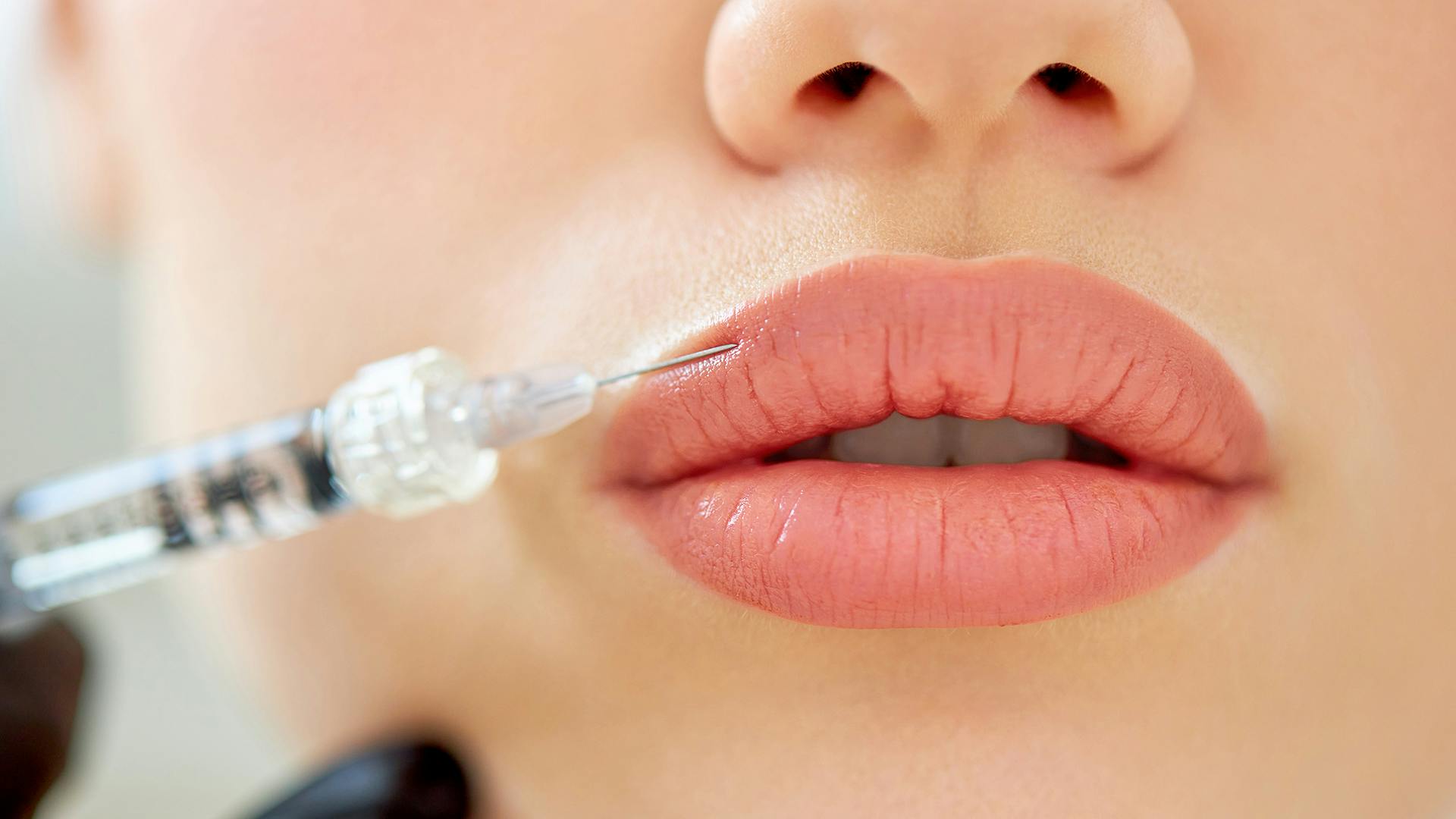 8 Uses for Dermal Fillers