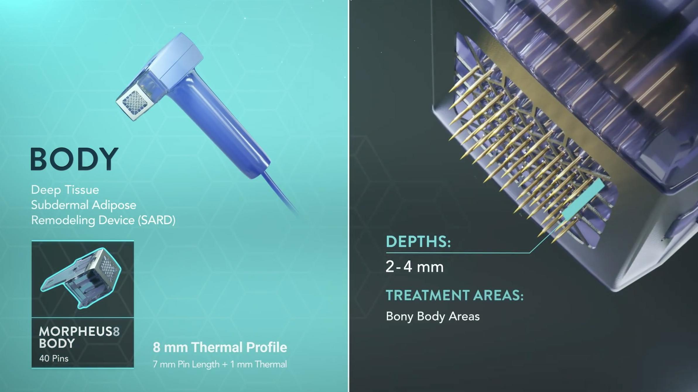 animated image showing the morpheus8 for body device