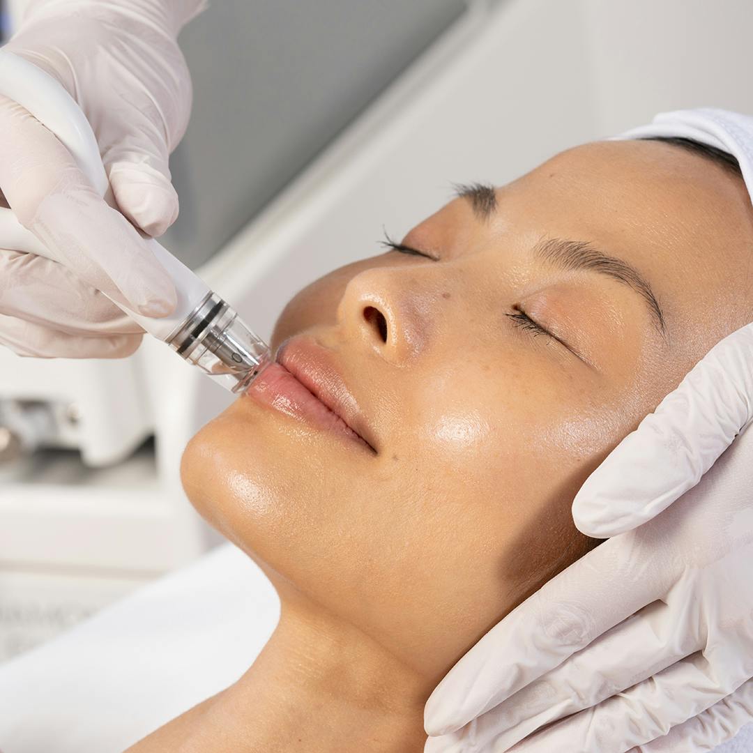 a patient receiving a laser treatment