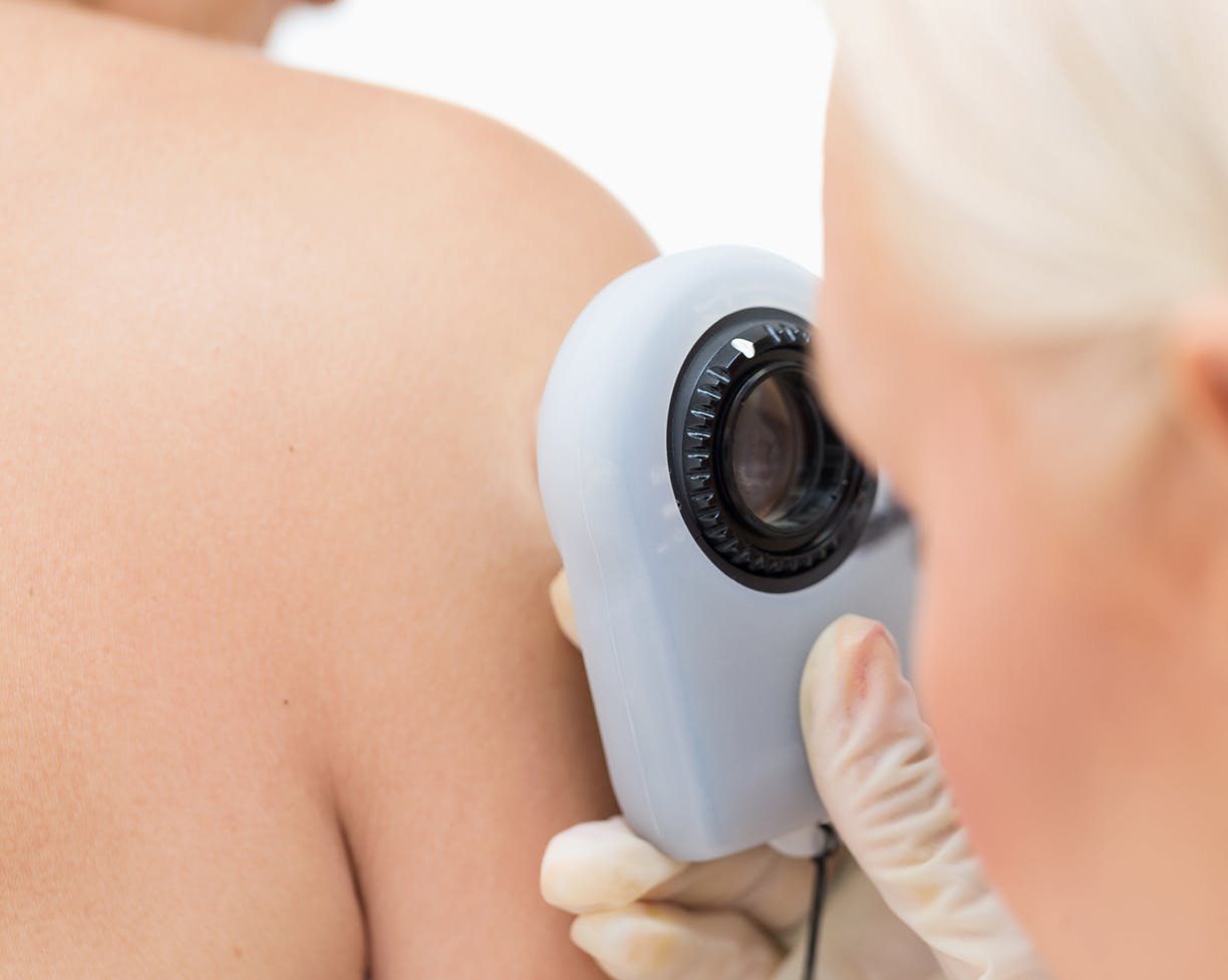 A doctor using a tool to look at a patient's skin