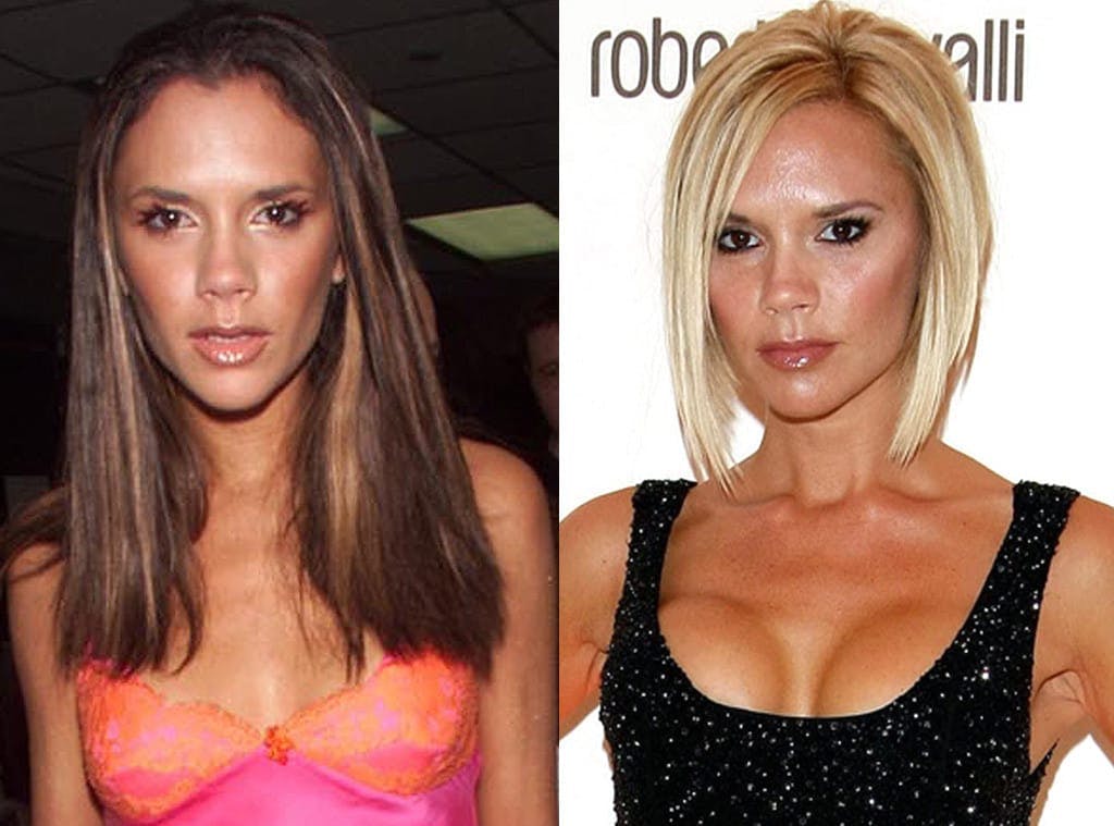 Celebs Admit to Plastic Surgery - Dr. Nassif Transforms Patients in Botched.