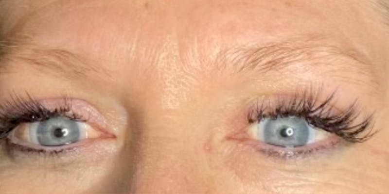 Microblading Before & After Gallery - Patient 146644071 - Image 1