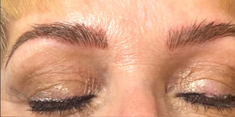 Microblading Before & After Gallery - Patient 146644069 - Image 2