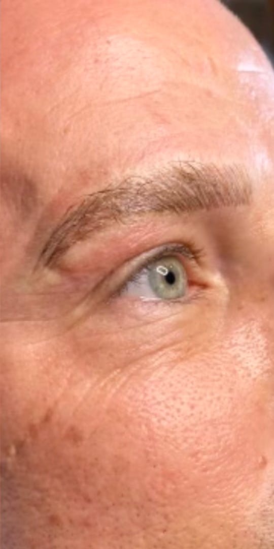 Microblading Before & After Gallery - Patient 146644068 - Image 2