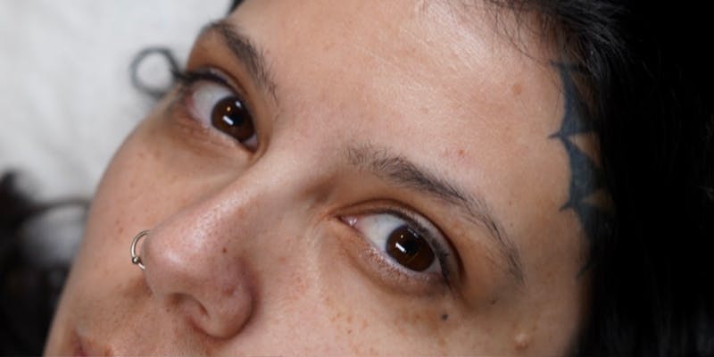 Microblading Before & After Gallery - Patient 146644074 - Image 1