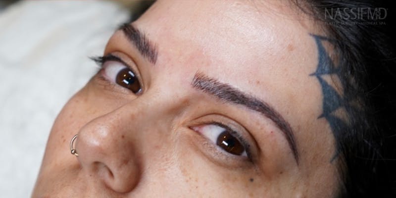 Microblading Before & After Gallery - Patient 146644074 - Image 2