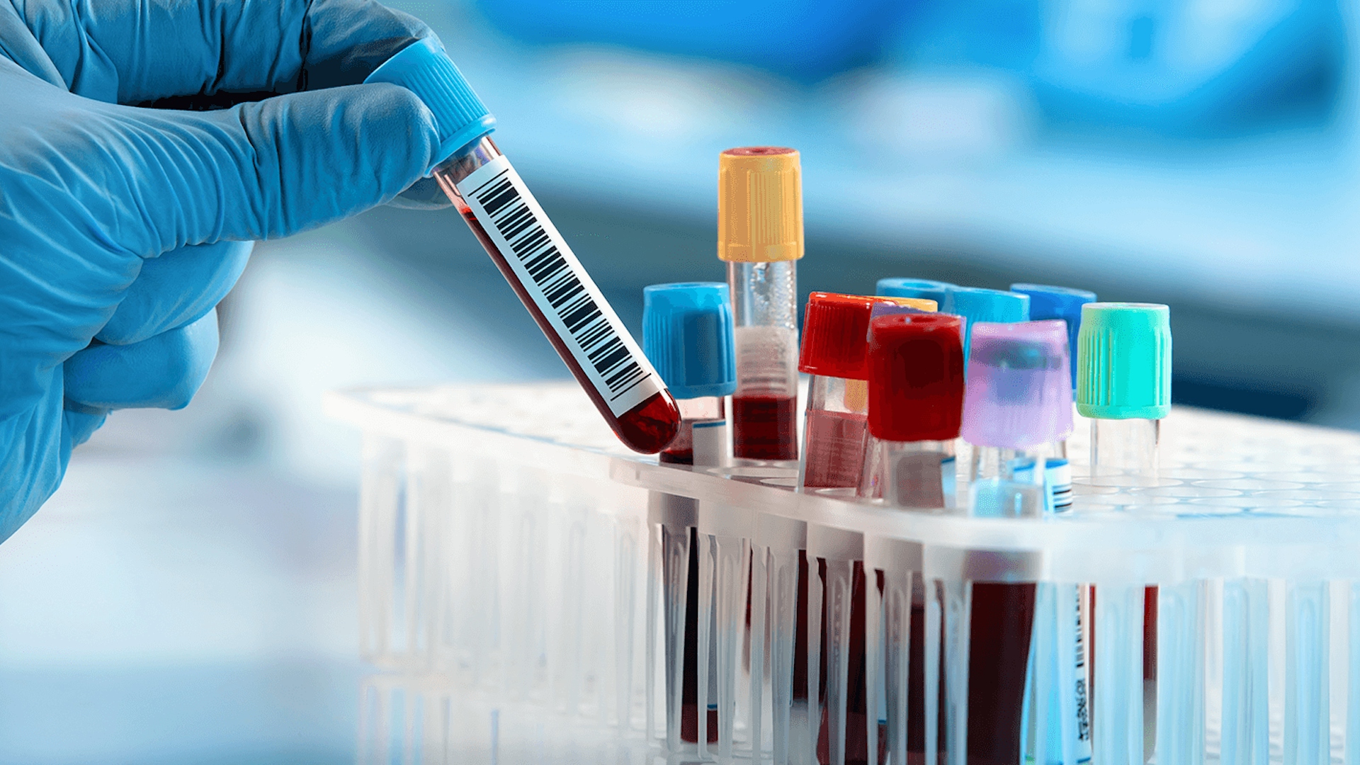 Wat Is Bezinking In Bloedonderzoek