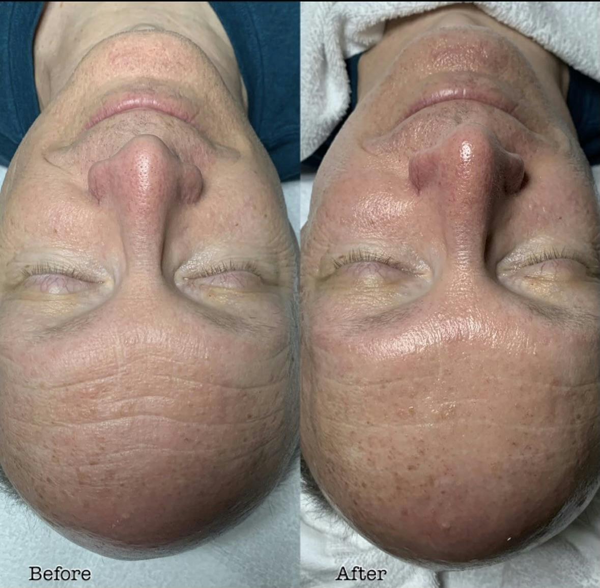 Derma Sweep