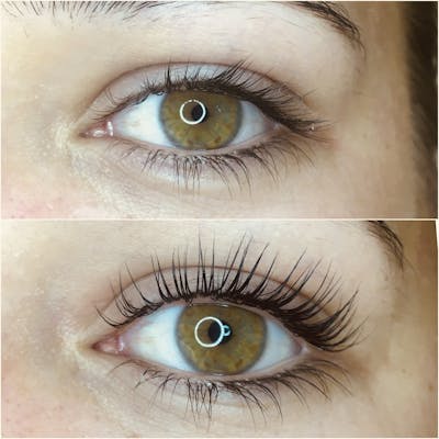 Lash Lift Before & After Gallery - Patient 219648 - Image 1